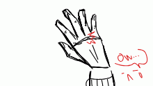 My hand is dying